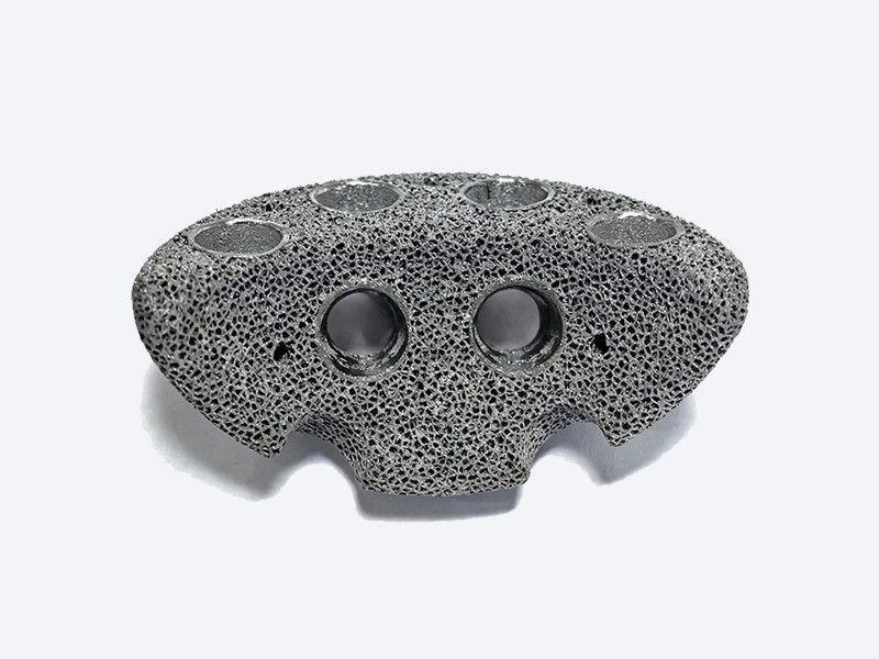 3D-Printed Acetabular Augment