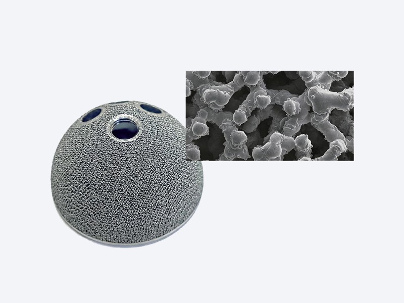 Trabecular Metal Acetabular Component